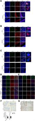 Different Aberrant Changes of mGluR5 and Its Downstream Signaling Pathways in the Scrapie-Infected Cell Line and the Brains of Scrapie-Infected Experimental Rodents